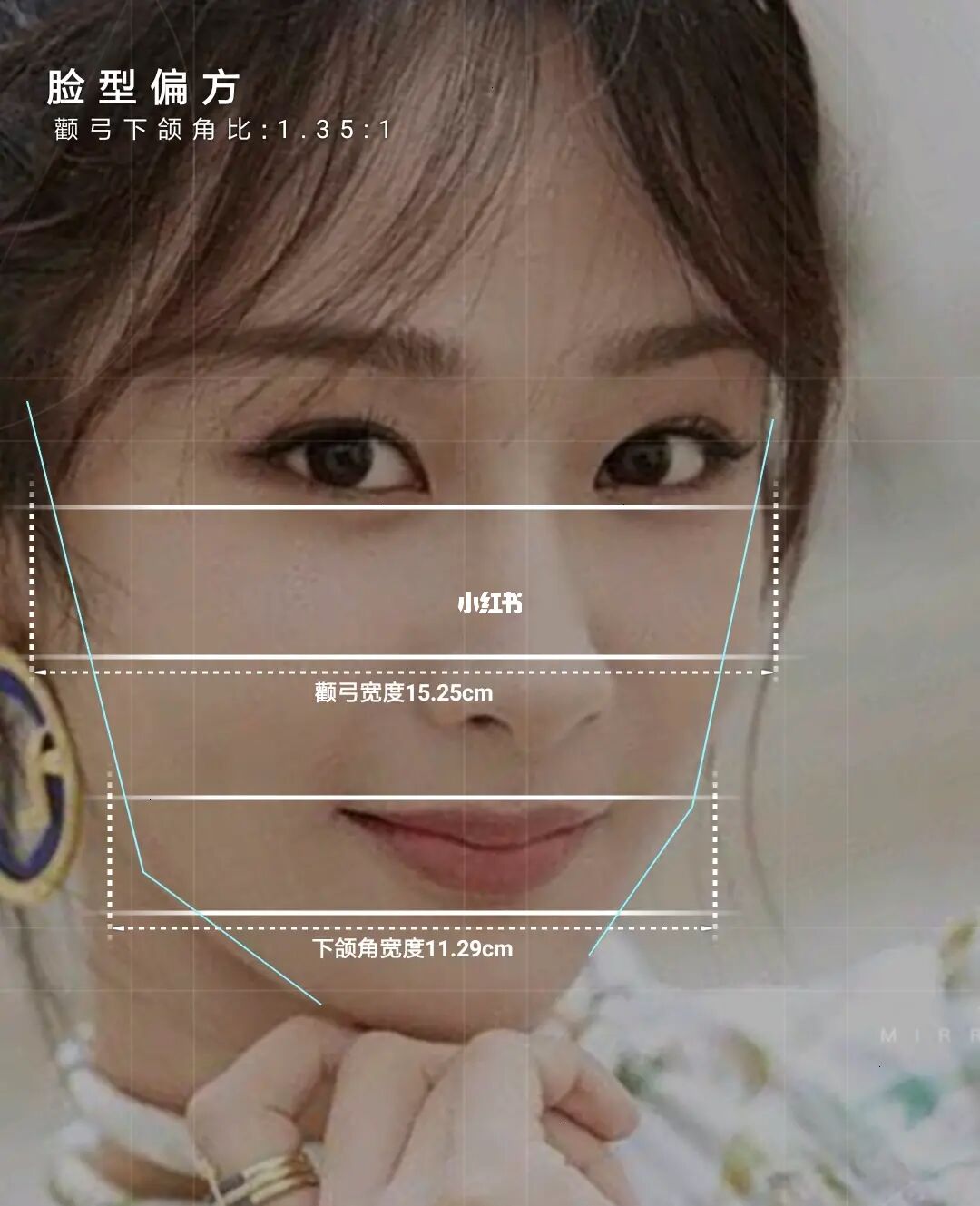 “瓜子脸”被称为“21世纪东方美女标准脸型”?